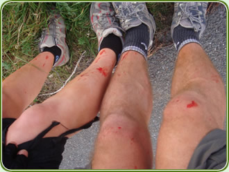 The beaten up legs after the 'shortcut'